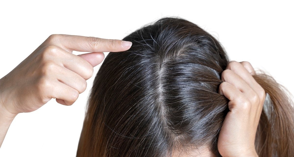 स्ट्रेस कम होने पर फिर से काले हो सकते हैं सफेद बाल, शोध में दावा
