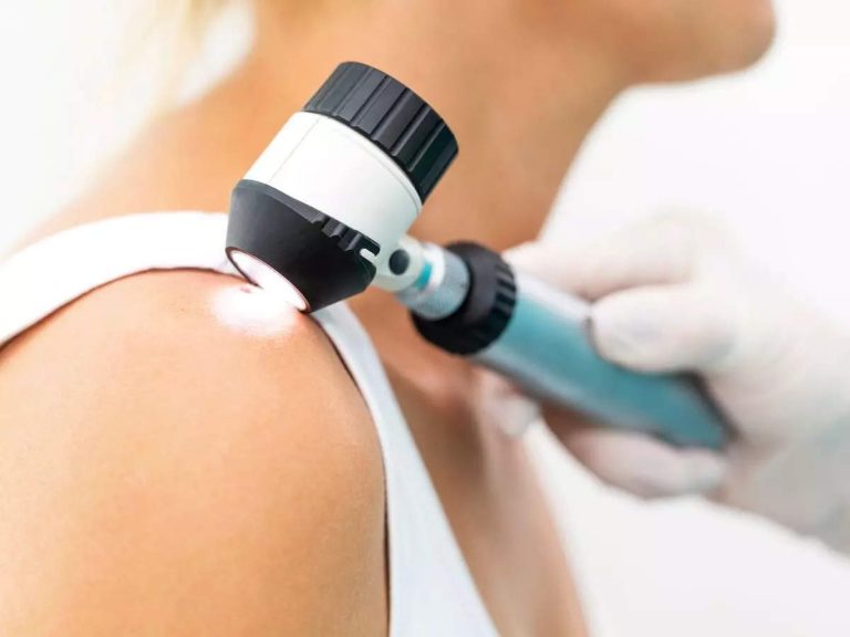 कैंसर लक्षण: त्वचा कैंसर के इन सामान्य क्षेत्रों से सावधान रहें |  द टाइम्स ऑफ़ इण्डिया.