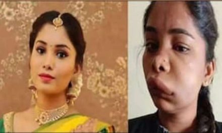 कन्नड़ अभिनेत्री स्वाति सतीश की रूट कैनाल सर्जरी हुई गलत, वायरल होने से पहले और बाद में देखें तस्वीर